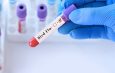 Bird Flu test in testtube stock image