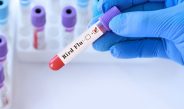 Bird Flu test in testtube stock image